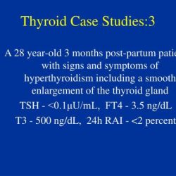 Thyroid disorders hesi case study