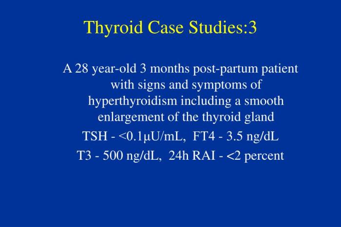 Thyroid disorders hesi case study