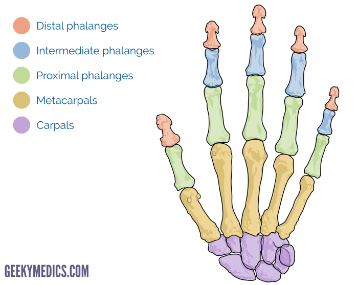 Fracture phalanx proximal displaced unstable