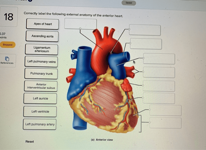 Correctly label the following external anatomy of the anterior heart.